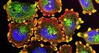 Custom cancer vaccines safely fight and kill tumors in early human trials