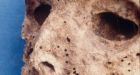 DNA analysis of mummified remains alters notion of how Renaissance-era child died