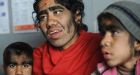 Spanish families prepare to sue pharmaceutical company after kids get werewolf syndrome