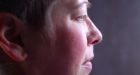 4 Canadians with terminal cancer win the right to try magic mushrooms