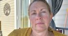Patient gets biopsy in U.S. after she says she was denied in Ontario due to ransomware attack