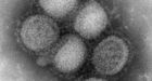 Severe H1N1 infections spike in B.C.