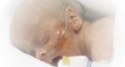 Canada ranked 25th in world infant mortality