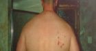 Five Mounties accused of torture