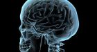 Man in coma conscious for decades