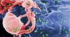 Number of Canadian babies getting HIV from moms now almost zero, conference told