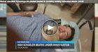 Brian Ogle, Ala. teen, hospitalized after pro-cop stance sparked assault: 'It's a hate crime'